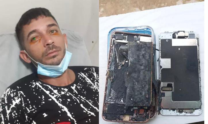 Celular explode em rosto de agricultor durante uso