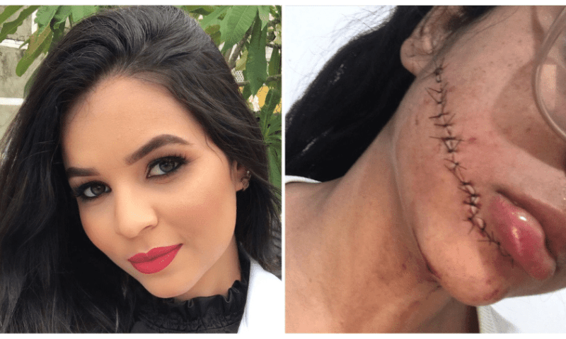 Vídeo mostra momento em que jovem tem rosto cortado dentro de ônibus; assista