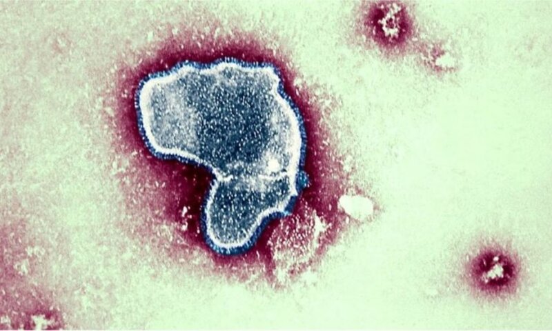 Pernambuco confirma sétimo caso de Candida auris; paciente é um homem de 69 anos