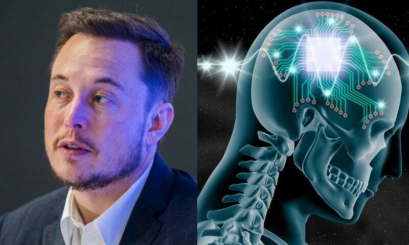 Empresa de Elon Musk, faz 1º implante de chip cerebral em humano