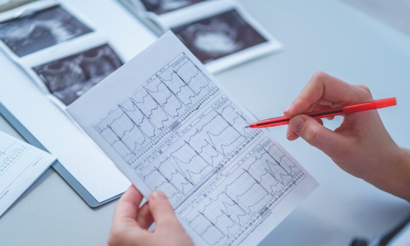 Aparelho que faz eletrocardiograma doméstico chega às farmácias do Brasil