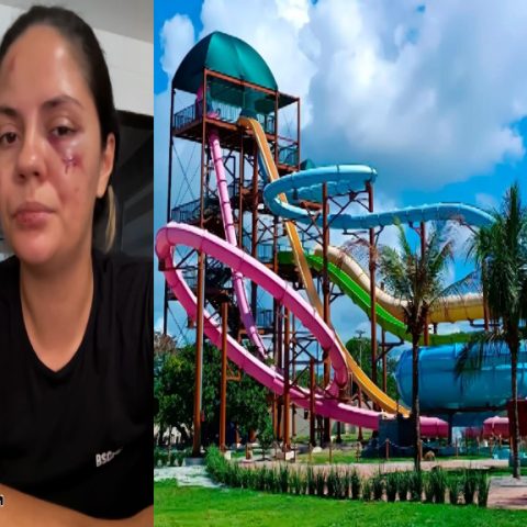 Mulher relata acidente em novo parque aquático na Praia dos Carneiros em Tamandaré