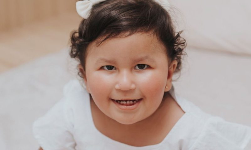 Síndrome rara causa ‘fome insaciável’ em bebê de 2 anos