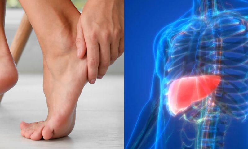 Atenção à saúde! Doenças no fígado podem se manifestar nos pés: conheça os sinais e cuidados