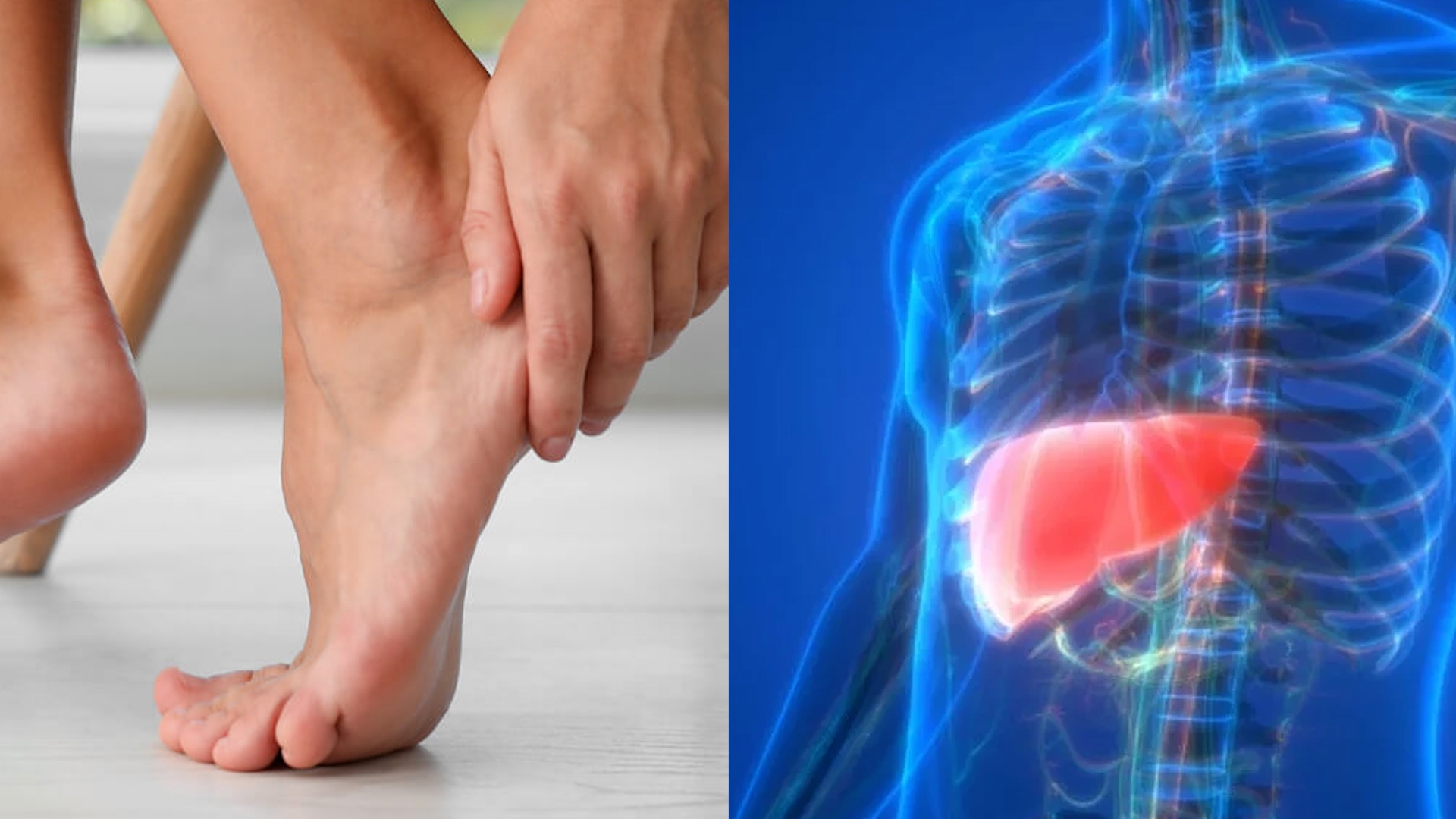 Atenção à saúde! Doenças no fígado podem se manifestar nos pés: conheça os sinais e cuidados