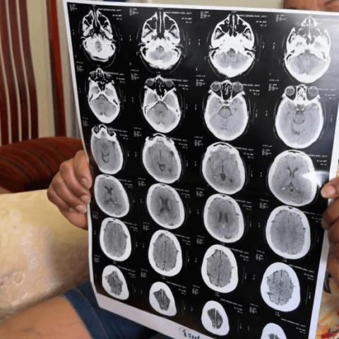 Fique atento: ‘Golpe do exame’ simula entrega de resultados para roubo de dados