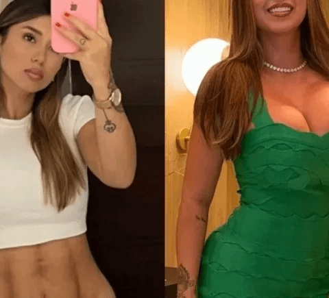 Influenciadora denuncia clínica após ter ‘corpo deformado’; Veja fotos!