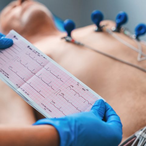 Eletrocardiograma pode ser solicitado mesmo sem sintomas aparentes; entenda