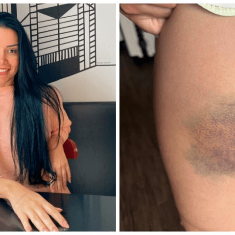 Nutricionista que lutou contra agressor para não ser estuprada revela que treinou muay thai, boxe, jiu-jítsu e defesa pessoal