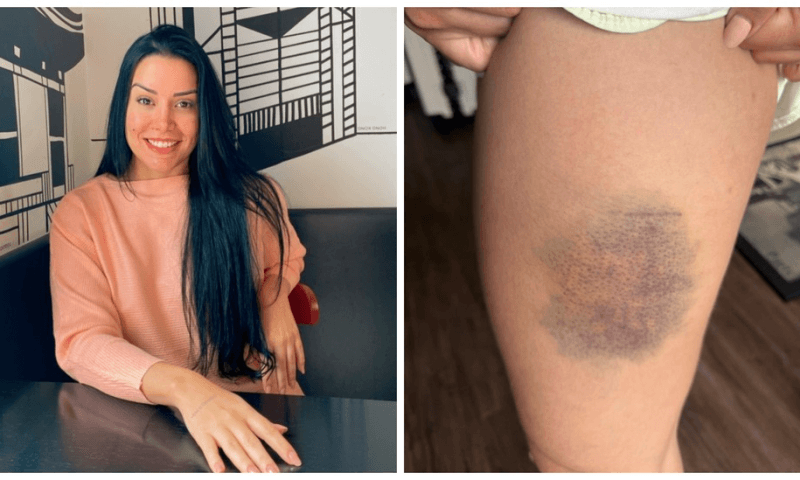 Nutricionista que lutou contra agressor para não ser estuprada revela que treinou muay thai, boxe, jiu-jítsu e defesa pessoal